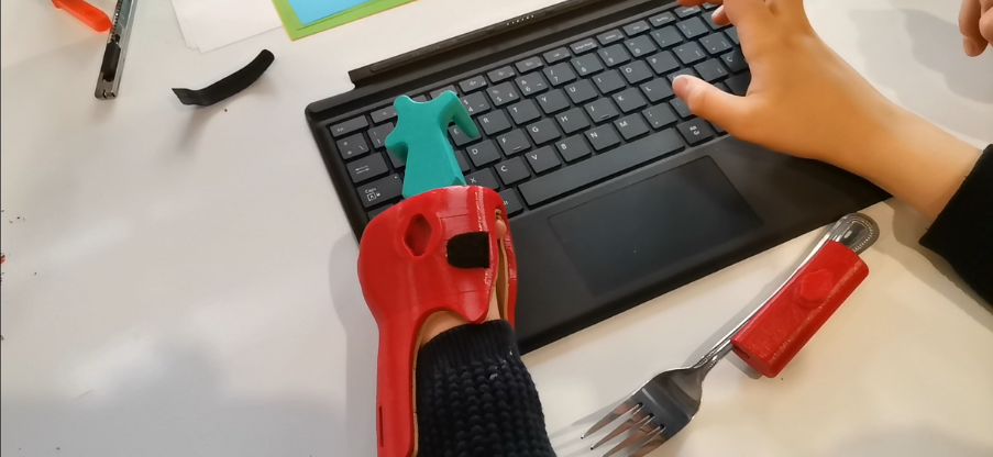 mano protésica